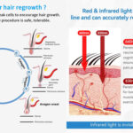 Red Light Therapy Cap by Genrevive